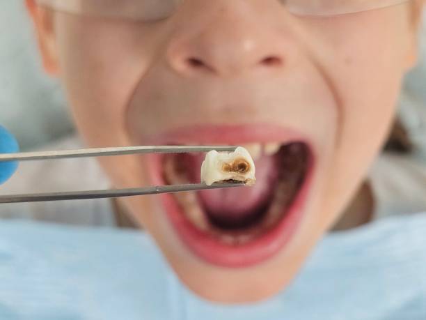 Best Weekend Emergency Dentist in Sneedville, TN