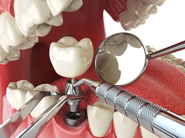 Best Broken or Cracked Tooth Emergency Dentist in Sneedville, TN